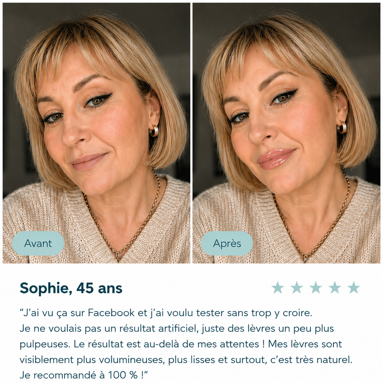 Agrandisseur de lèvres Norysia